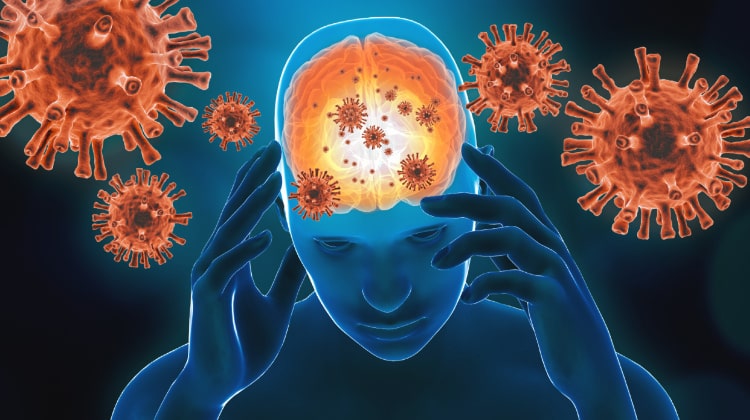 新型コロナウイルスによる脳梗塞
